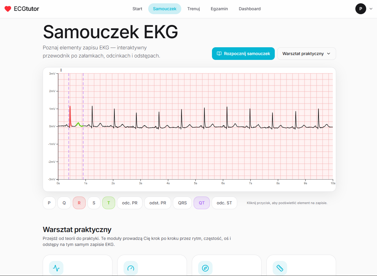ECG Tutorial