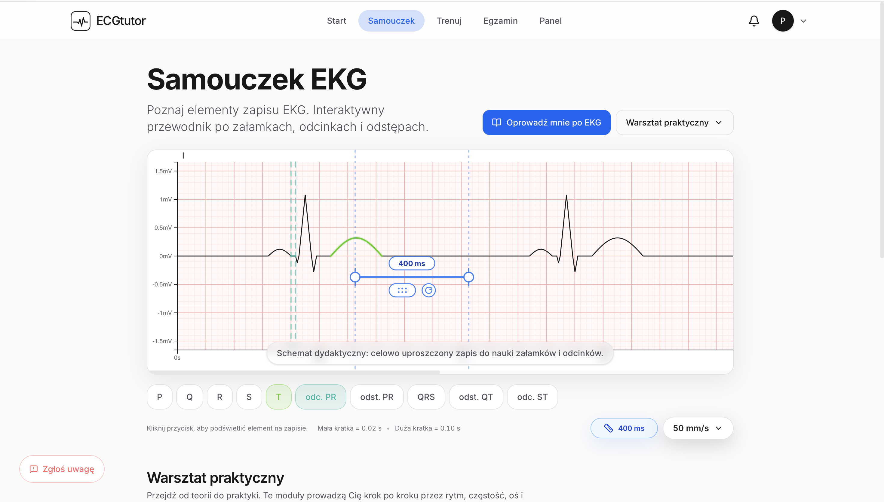 ECG Tutorial Overview